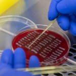 Chcą rozbroić bakterię E. coli. Kluczem może być analiza jej "tarczy"