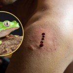 Chciała oczyścić organizm, trafiła na toksykologię. Kobieta w stanie ciężkim