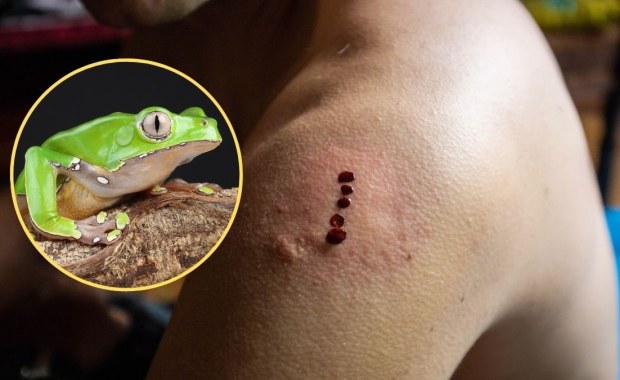 Chciała oczyścić organizm, trafiła na toksykologię. Kobieta w stanie ciężkim