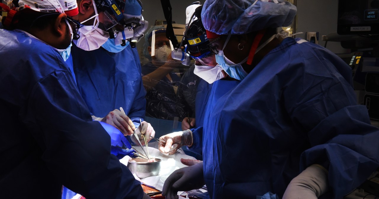 Chirurdzy podczas operacji /materiały prasowe