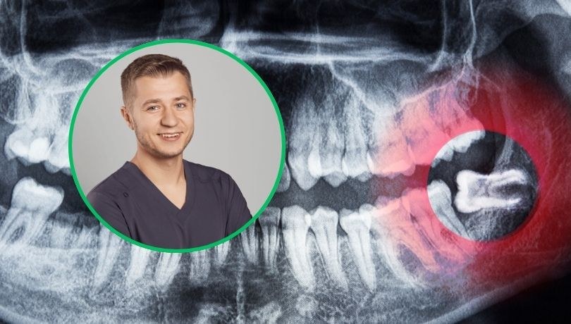 Chirurg stomatologiczny Bartłomiej Warchoł mówi, kiedy trzeba usuwać "ósemki" /Materiały prasowe