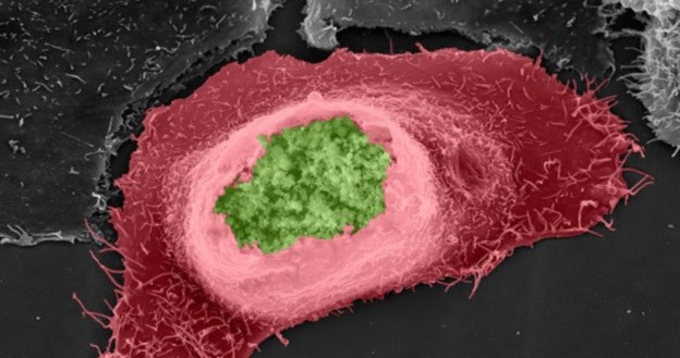 Chlamydia trachomatis (zielona) w komórce gospodarza (czerwona) /materiały prasowe