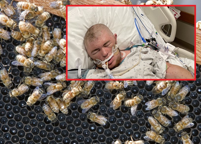Chłopak został użądlony przez pszczoły ponad 20 tys. razy / Twitter @paytontvnews /PAUL J. RICHARDS / AFP /AFP