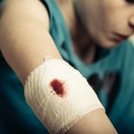 Chłopiec bawił się wiatrówką. Postrzelił kolegę