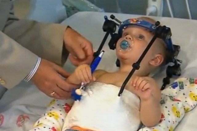 Chłopiec musi mieć przez 8 tygodni unieruchomioną głowę. Kadr z materiału australijskiej telewizji 7 News /YouTube