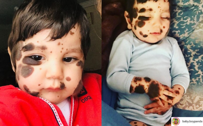 Chłopiec niedługo skończy dwa lata /Instagram / baby.boypanda /Instagram
