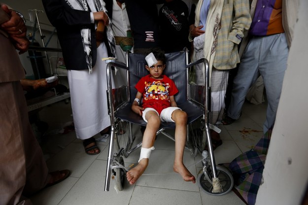 Chłopiec ranny w jednym z ataków samobójczych w Jemenie /YAHYA ARHAB /PAP/EPA