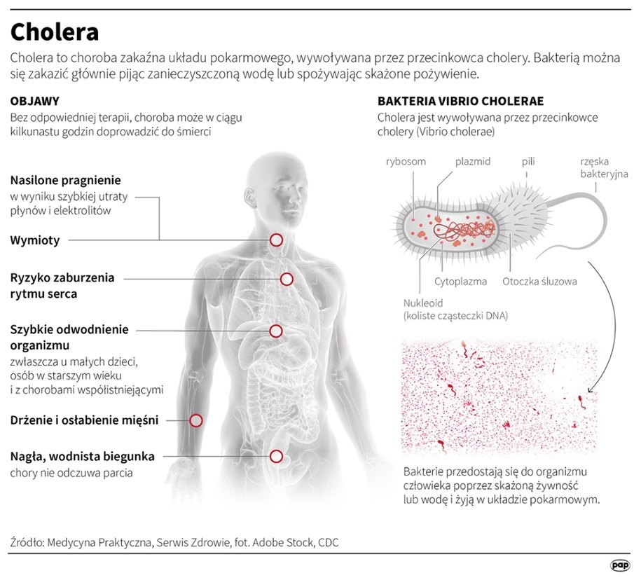 Cholera i jej objawy /Mateusz Krymski /PAP