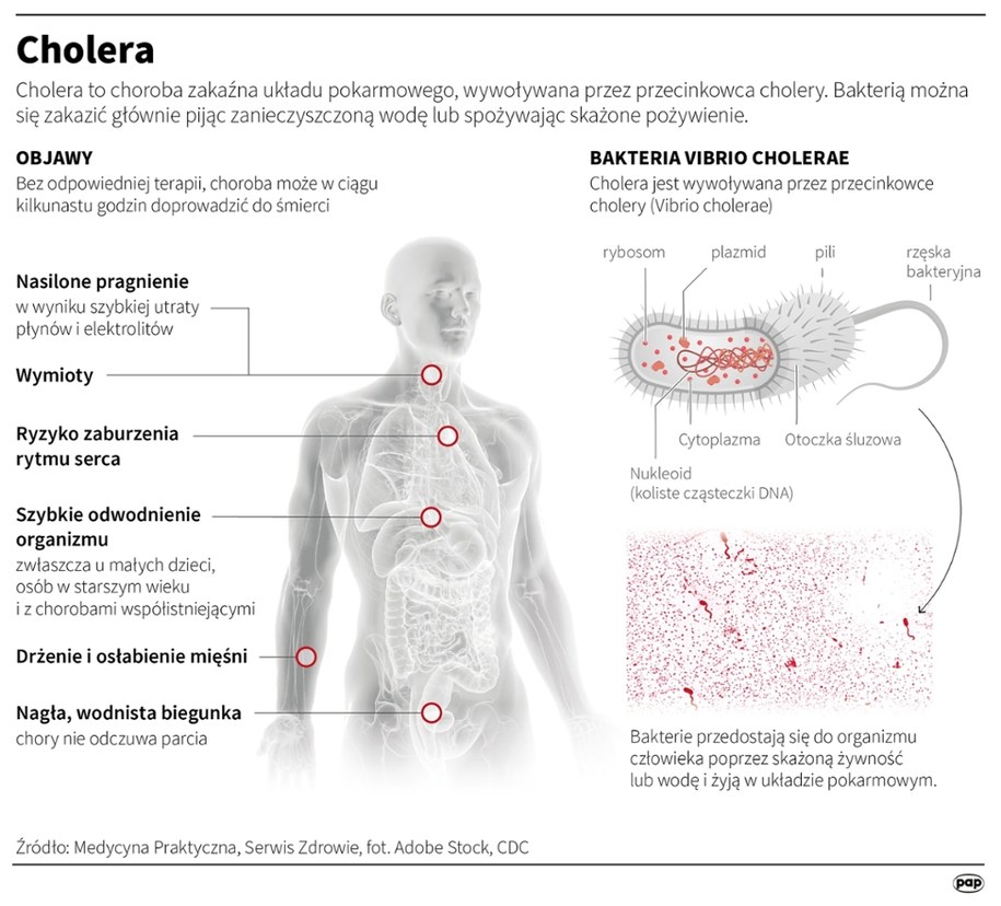 Cholera /Mateusz Krymski /PAP