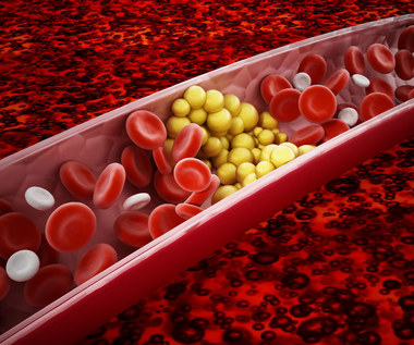 Cholesterol: Dlaczego warto go często badać?