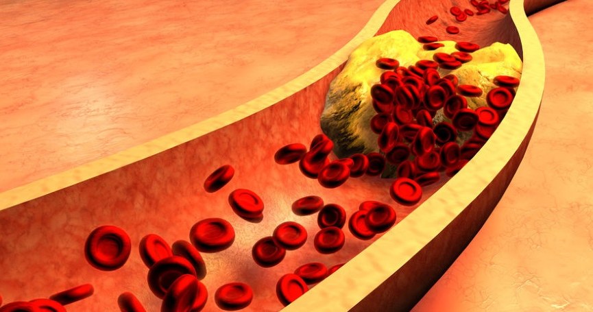 Cholesterol LDL szkodzi /123RF/PICSEL