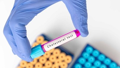 Cholesterol – to rodzinne? Zrób prosty test