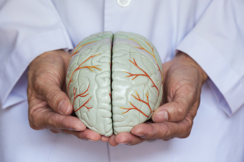 Chorób układu nerwowego jest wiele - poczynając od migren po udary czy guzy mózgu /123RF/PICSEL
