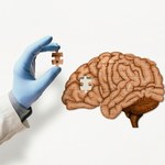 Choroba Alzheimera dotyka młodych. Ujawniono niepokojące dane