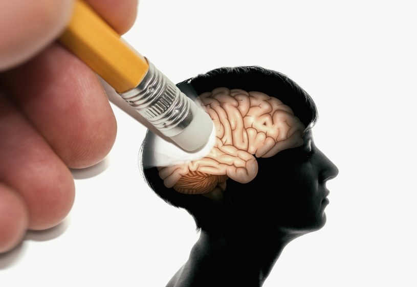 Choroba Alzheimera prowadzi do otępienia mózgowego, które charakteryzuje się utratą pamięci /123RF/PICSEL