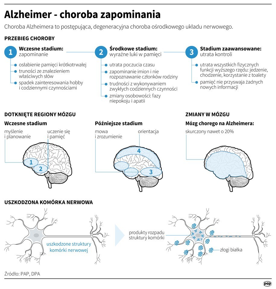 Choroba Alzheimera rozwija się stopniowo i uszkadza mózg /Infografika /PAP/DPA /