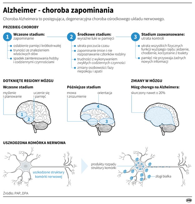 Choroba Alzheimera rozwija się stopniowo i uszkadza mózg /Infografika /PAP/DPA