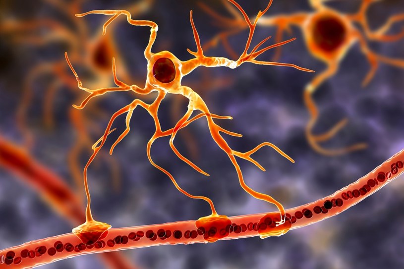 Choroba Alzheimera skutkuje degeneracją neuronów /123RF/PICSEL