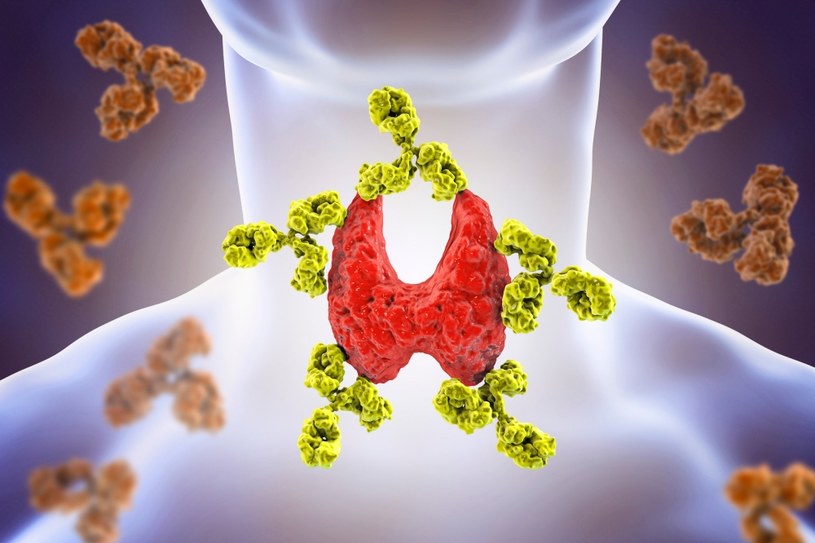 Choroba Gravesa-Basedowa to autoimmunologiczna choroba powodująca nadprodukcję hormonów tarczycy /123RF/PICSEL