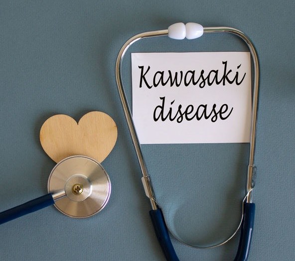 Choroba Kawasakiego Przyczyny Objawy I Leczenie Porady W Interiapl 0637