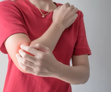 Choroba skóry może zaatakować stawy. Objawy przypominają kontuzję lub zwyrodnienia