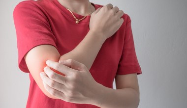 Choroba skóry może zaatakować stawy. Objawy przypominają kontuzję lub zwyrodnienia