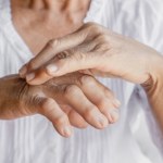 objawy łuszczycy Choroba skóry może zaatakować stawy. Objawy przypominają kontuzję lub zwyrodnienia