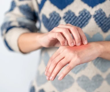 Choroba wpływa na psychikę, a psychika na chorobę. Tak działa błędne koło łuszczycy