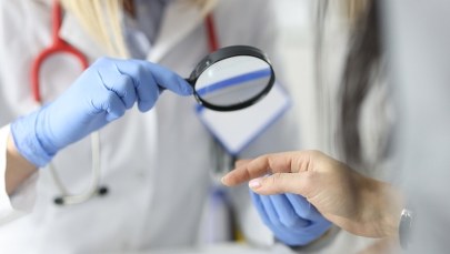 Choroby, które wyczytasz ze swojej skóry