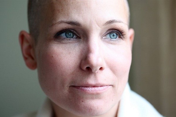 Choroby nowotworowe /© Photogenica