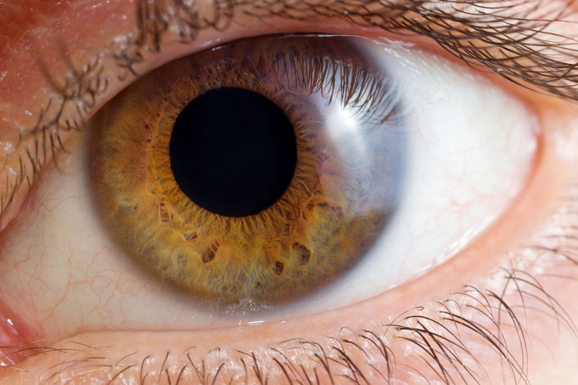 Choroby oczu mają związek z zaburzeniami ukrwienia /123RF/PICSEL
