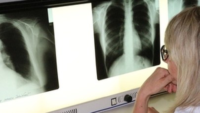 ​Choroby płuc. Wszyscy jesteśmy w grupie ryzyka