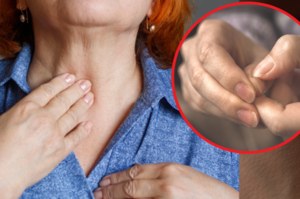 Choroby tarczycy można wyczytać z paznokci. Tak wyglądają tarczycowe paznokcie