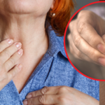 Choroby tarczycy można wyczytać z paznokci. Tak wyglądają tarczycowe paznokcie