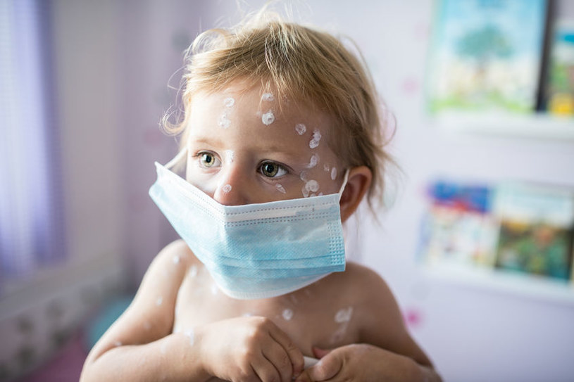 download monkey pox quarantine
