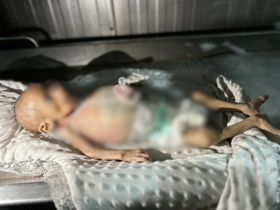 Ciało 6-miesięcznego dziecka, które zmarło z niedożywienia, Strefa Gazy, 26.07.2025 /Rex Features/EAST NEWS /East News