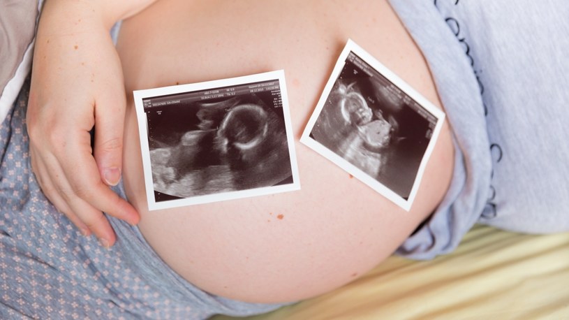 Ciąże wielopłodowe są niepoznaną do końca tajemnicą natury /123RF/PICSEL