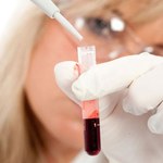 Co może ujawnić badanie krwi?