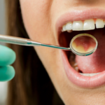 Co można zrobić z zębami na NFZ? O tych zabiegach nie miałeś pojęcia