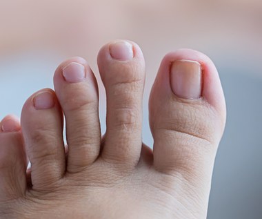 Co o twoim zdrowiu i życiu mówi kształt stopy? Zwróć uwagę na palce