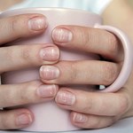 Co oznaczają białe paznokcie?