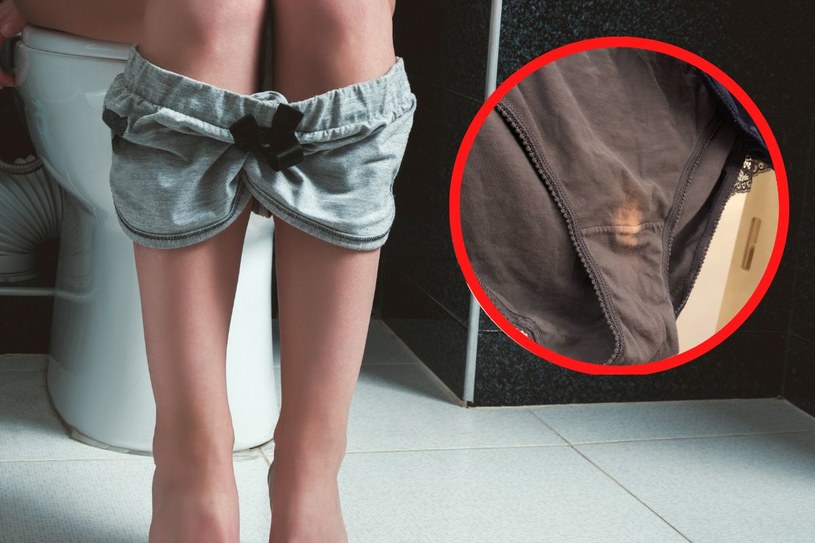 Co oznaczają jasne przebarwienia na majtkach? /Facebook/Vagina Museum /123RF/PICSEL