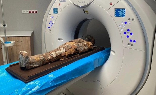 Co ukrywa mumia chłopca z Wrocławia? Zaskakujące odkrycie pod bandażami