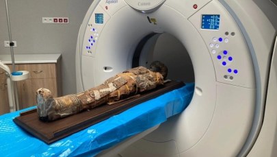 Co ukrywa mumia chłopca z Wrocławia? Zaskakujące odkrycie pod bandażami