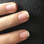 Co znaczą białe zmiany na paznokciach? Nie musi być to powód do obaw