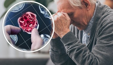 Cofnęli Alzheimera u myszy i przywrócili im pamięć. Zadziała też u ludzi?