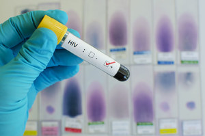 Coraz bliżej stworzenia szczepionki na HIV