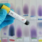 Coraz bliżej stworzenia szczepionki na HIV