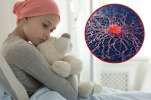 Coraz młodsi chorują na raka. Dostrzeżenie wczesnych objawów zwiększa ich szansę na przeżycie
