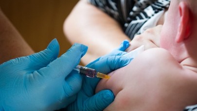 Coraz więcej chorych na ospę wietrzną